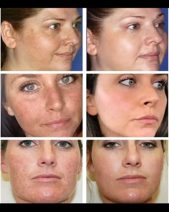 Feature product image